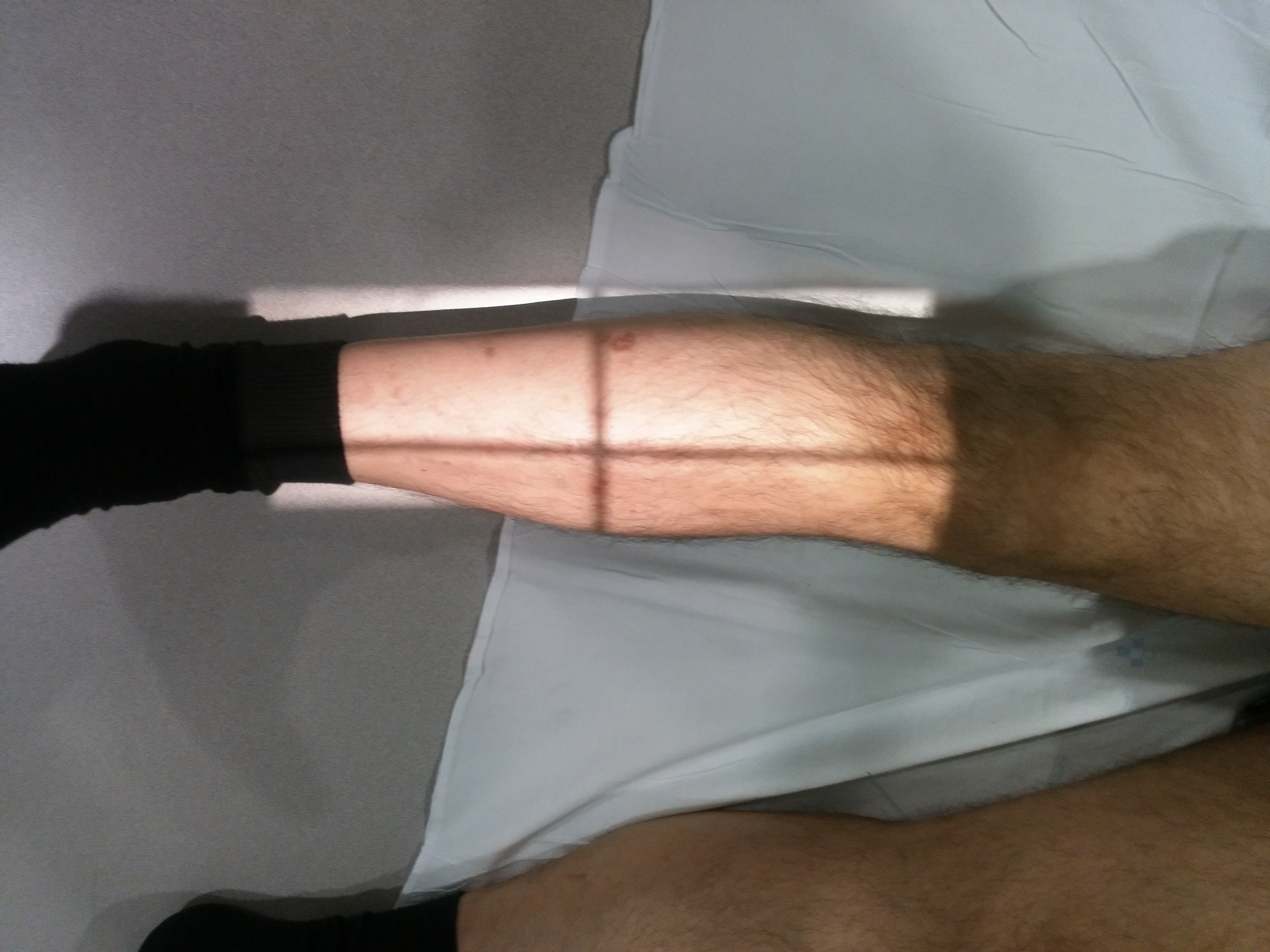 Lateral Leg Projection